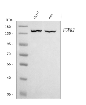FGFR2 Rabbit Polyclonal Antibody