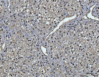 FAA/FAH Rabbit Polyclonal Antibody