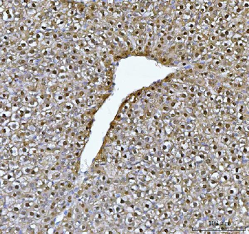 FAA/FAH Rabbit Polyclonal Antibody