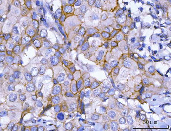 HER2/ERBB2 Antibody