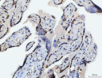 C1orf77/FOP/CHTOP Antibody