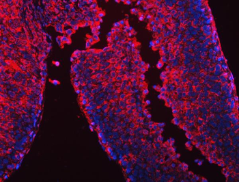 CES2 Rabbit Polyclonal Antibody