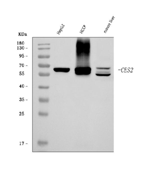 CES2 Rabbit Polyclonal Antibody