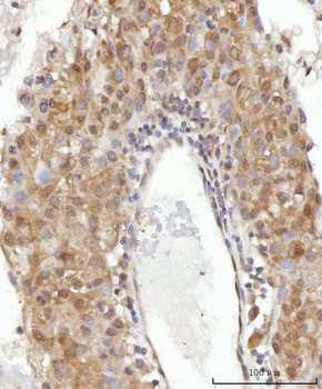 CEP250 Rabbit Polyclonal Antibody