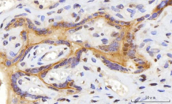 CEP250 Rabbit Polyclonal Antibody