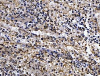 CEP250 Rabbit Polyclonal Antibody