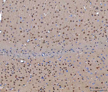 CEP250 Rabbit Polyclonal Antibody