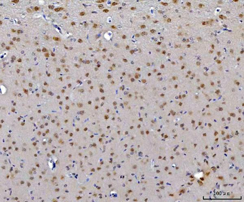 CEP250 Rabbit Polyclonal Antibody