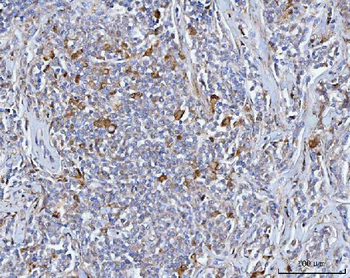 BCAT1 Rabbit Polyclonal Antibody