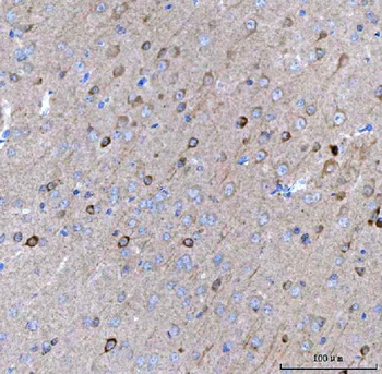 BCAT1 Rabbit Polyclonal Antibody