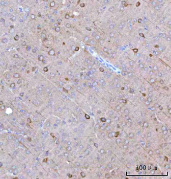 BCAT1 Rabbit Polyclonal Antibody