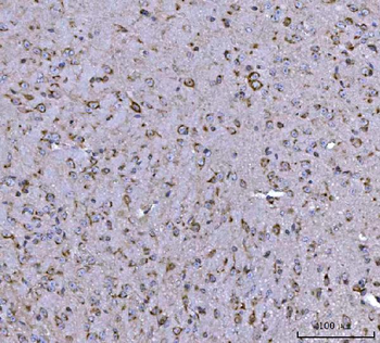 BBS9 Antibody