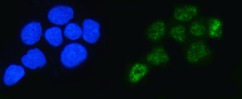 ALYREF Rabbit Polyclonal Antibody