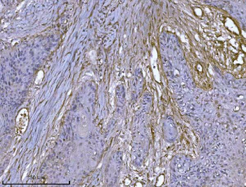 Integrin linked ILK Antibody (monoclonal, 3C7E1)