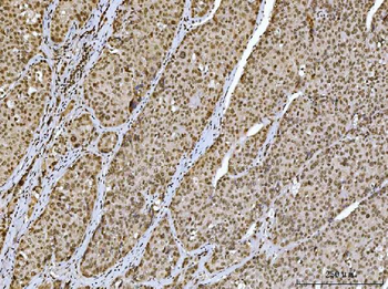 Ataxin 1 Antibody (monoclonal, 2B13G8)