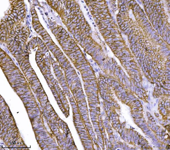 delta 1 Catenin/CAS/CTNND1 Mouse Monoclonal Antibody
