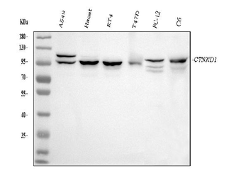 delta 1 Catenin/CAS/CTNND1 Mouse Monoclonal Antibody
