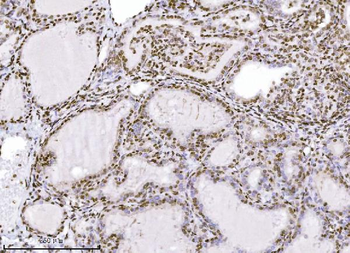 KPNB1 Antibody (monoclonal, 3I11F2)