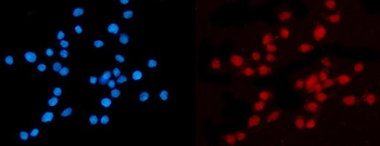 KPNB1 Antibody (monoclonal, 3I11F2)