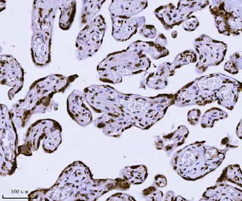 KPNB1 Antibody (monoclonal, 3I11F2)