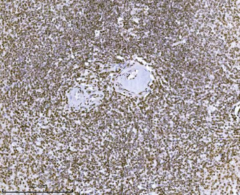 KPNB1 Antibody (monoclonal, 3I11F2)