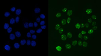 RCC1 Mouse Monoclonal Antibody