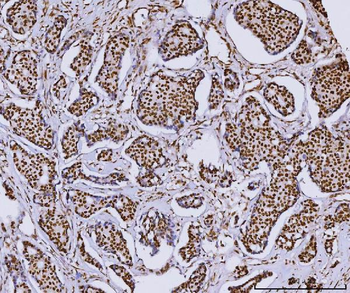 RCC1 Mouse Monoclonal Antibody