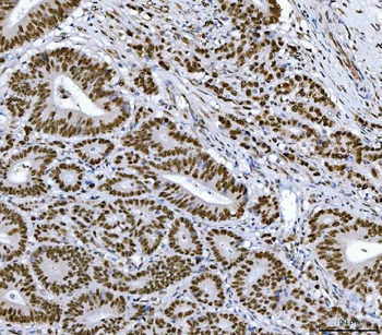 RCC1 Mouse Monoclonal Antibody