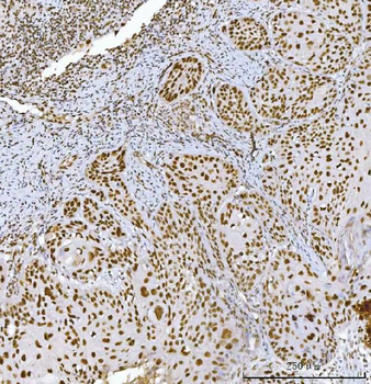 RCC1 Mouse Monoclonal Antibody