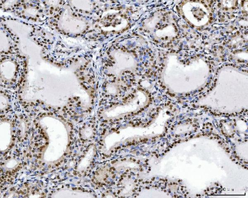 RCC1 Mouse Monoclonal Antibody