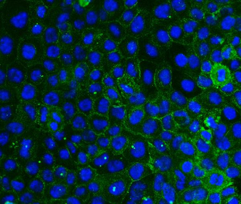 Integrin beta 4/ITGB4 Antibody (monoclonal, 7G10D2)
