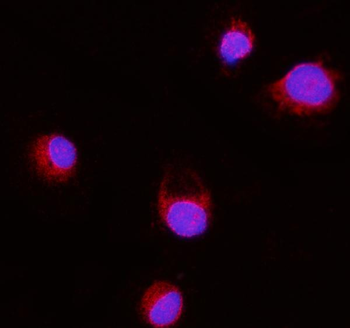 Erlin-2/ERLIN2 Mouse Monoclonal Antibody