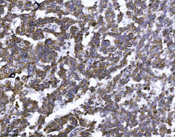 Erlin-2/ERLIN2 Mouse Monoclonal Antibody
