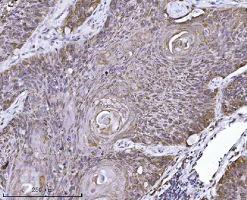 Erlin-2/ERLIN2 Mouse Monoclonal Antibody