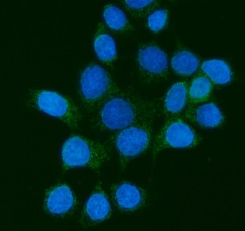 MPPB/PMPCB Mouse Monoclonal Antibody