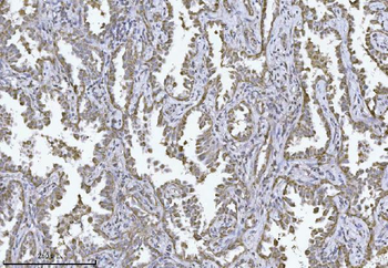 MPPB/PMPCB Mouse Monoclonal Antibody