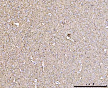Drebrin/DBN1 Antibody (monoclonal, 4F6E7)