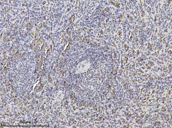 SLC4A1/CD233/Band 3 Mouse Monoclonal Antibody