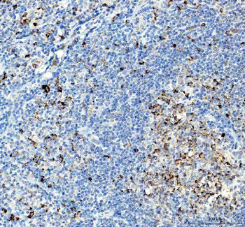 VPAC2/VIPR2 Rabbit Polyclonal Antibody