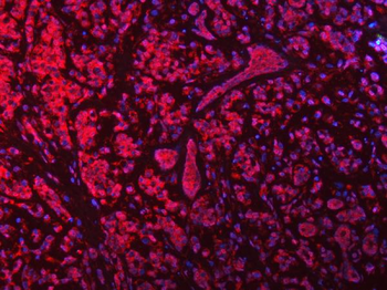 MSF/SEPTIN9 Rabbit Polyclonal Antibody