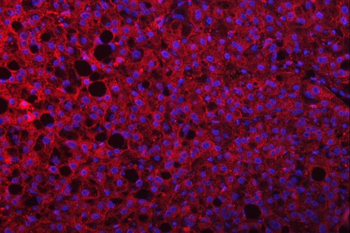 MSF/SEPTIN9 Rabbit Polyclonal Antibody