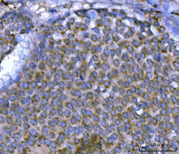 MSF/SEPTIN9 Rabbit Polyclonal Antibody