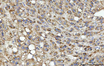 MSF/SEPTIN9 Rabbit Polyclonal Antibody
