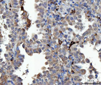 MSF/SEPTIN9 Rabbit Polyclonal Antibody