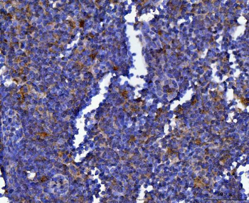 MSF/SEPTIN9 Rabbit Polyclonal Antibody