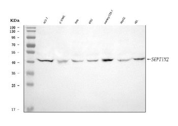 Septin 2/SEPTIN2 Rabbit Polyclonal Antibody