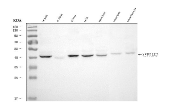Septin 2/SEPTIN2 Rabbit Polyclonal Antibody