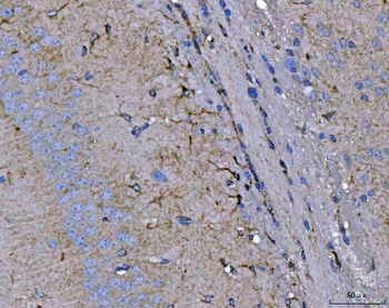 Septin 2/SEPTIN2 Rabbit Polyclonal Antibody