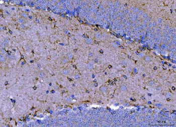 Septin 2/SEPTIN2 Rabbit Polyclonal Antibody