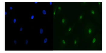 TIP49A/RUVBL1 Rabbit Polyclonal Antibody